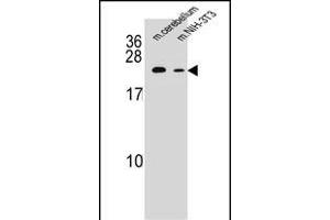 RAB12 Antibody (N-term) (ABIN655307 and ABIN2844889) western blot analysis in mouse cerebellum tissue and mouse NIH-3T3 cell line lysates (35 μg/lane). (RAB12 Antikörper  (N-Term))