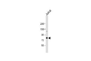 Anti-ALKBH8 Antibody (C-term) at 1:1000 dilution + Jurkat whole cell lysate Lysates/proteins at 20 μg per lane.