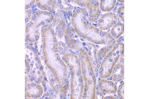 Immunohistochemistry of paraffin-embedded rat kidney using ACAA1 antibody at dilution of 1:100 (x400 lens).