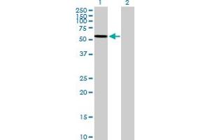 Western Blot analysis of ARSA expression in transfected 293T cell line by ARSA MaxPab polyclonal antibody. (Arylsulfatase A Antikörper  (AA 1-507))