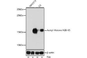 Western blot analysis of extracts of various cell lines, using Acetyl-Histone H2B-K5 antibody (ABIN7267733) at 1:1000 dilution.