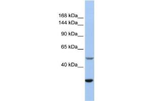 Western Blotting (WB) image for anti-Zinc Finger, ZZ-Type Containing 3 (ZZZ3) (Isoform 3), (Middle Region) antibody (ABIN1449842)