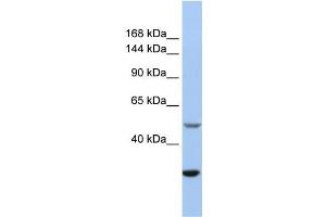 Human Jurkat; WB Suggested Anti-ZZZ3 Antibody Titration: 0. (ZZZ3 Antikörper  (Isoform 3, Middle Region))