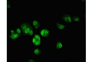 Immunofluorescent analysis of MCF-7 cells using ABIN7172471 at dilution of 1:100 and Alexa Fluor 488-congugated AffiniPure Goat Anti-Rabbit IgG(H+L)