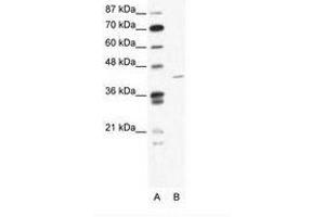 Image no. 1 for anti-Zinc Finger Protein 568 (ZNF568) (AA 121-170) antibody (ABIN202378) (ZNF568 Antikörper  (AA 121-170))