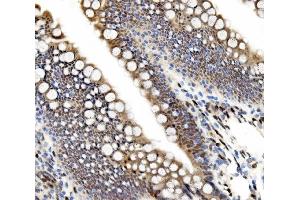 IHC analysis of ETF/TEAD2 using anti-ETF/TEAD2 antibody (ABIN7599879). (TEAD2 Antikörper  (AA 125-398))