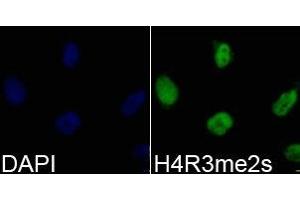 Immunofluorescence analysis of 293T cell using H4R3me2s antibody. (Histone 3 Antikörper  (2meArg3))