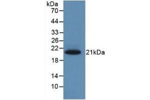 Detection of Recombinant CBG, Rat using Monoclonal Antibody to Corticosteroid Binding Globulin (CBG) (SERPINA6 Antikörper  (AA 173-344))