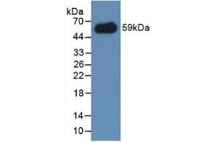 Detection of Recombinant IREM1, Mouse using Polyclonal Antibody to Immune Receptor Expressed On Myeloid Cells 1 (IREM1) (IREM1 Antikörper  (AA 45-310))