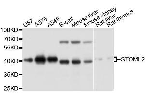 Western blot analysis of extracts of various cell lines, using STOML2 antibody. (STOML2 Antikörper  (AA 29-356))