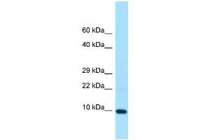 WB Suggested Anti-LSM5 Antibody Titration: 1. (LSM5 Antikörper  (Middle Region))