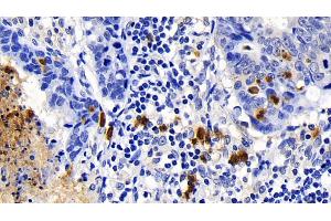 Immunohistochemistry (IHC) image for anti-Caspase 1 (CASP1) (AA 120-297) antibody (ABIN7433831)