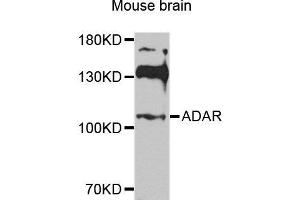 Western blot analysis of extracts of various cell lines, using ADAR antibody. (ADAR Antikörper  (AA 150-250))