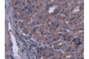 IHC-P analysis of Mouse Stomach Tissue, with DAB staining. (MARS Antikörper  (AA 74-212))