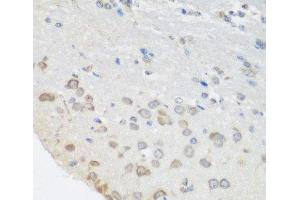 Immunohistochemistry of paraffin-embedded Mouse brain using PUM1 Polyclonal Antibody at dilution of 1:100 (40x lens). (PUM1 Antikörper)