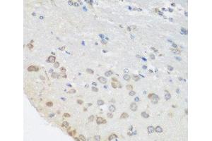 Immunohistochemistry of paraffin-embedded Mouse brain using PUM1 Polyclonal Antibody at dilution of 1:100 (40x lens).