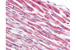 Anti-TUBB / Tubulin, Beta antibody IHC of human heart.