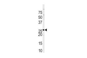 Western Blotting (WB) image for anti-Sprouty RTK Signaling Antagonist 4 (SPRY4) (AA 270-301), (C-Term) antibody (ABIN391651)