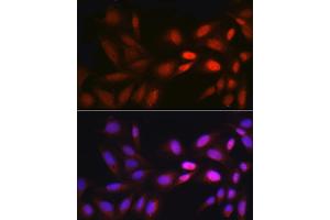 Immunofluorescence analysis of U2OS cells using EGR1 Rabbit pAb (ABIN3016527, ABIN3016528, ABIN3016529 and ABIN1679679) at dilution of 1:250 (40x lens). (EGR1 Antikörper)