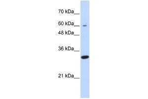 WB Suggested Anti-LRRC57 Antibody Titration: 0. (LRRC57 Antikörper  (N-Term))