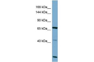 Host:  Rabbit  Target Name:  OCA2  Sample Type:  OVCAR-3 Whole cell lysates  Antibody Dilution:  1.
