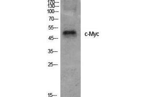Western Blot (WB) analysis of specific cells using c-Myc Polyclonal Antibody. (c-MYC Antikörper  (Ser95))
