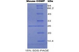 SDS-PAGE (SDS) image for Cartilage Oligomeric Matrix Protein (COMP) (AA 554-753) protein (His tag) (ABIN1980903)