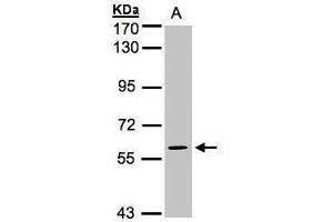 WB Image Sample(30 ug whole cell lysate) A:H1299 7. (MAPK4 Antikörper)