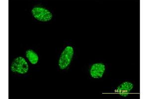 Immunofluorescence of monoclonal antibody to PPIG on HeLa cell. (PPIG Antikörper  (AA 13-106))