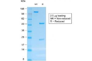 SDS-PAGE Analysis Purified CD30 Mouse Recombinant Monoclonal Antibody (rCD30/412). (Rekombinanter TNFRSF8 Antikörper)