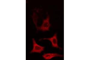 ABIN6274651 staining HT29 cells by IF/ICC. (CYP2R1 Antikörper  (Internal Region))