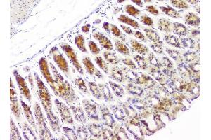 IHC analysis of HECTD3 using anti-HECTD3 antibody (ABIN6719595). (HECTD3 Antikörper)