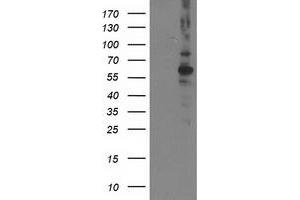 Western Blotting (WB) image for anti-Protein Phosphatase, Mg2+/Mn2+ Dependent, 1B (PPM1B) antibody (ABIN1500376) (PPM1B Antikörper)