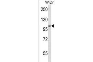 SDCCAG1 Antibody (N-term) (ABIN1539209 and ABIN2850179) western blot analysis in WiDr cell line lysates (35 μg/lane). (NEMF Antikörper  (N-Term))