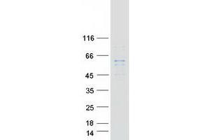 Western Blotting (WB) image for Diacylglycerol Kinase, epsilon 64kDa (DGKE) protein (Myc-DYKDDDDK Tag) (ABIN2715546)