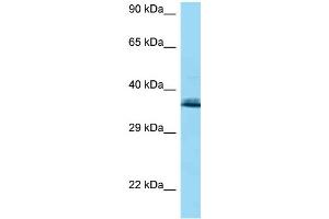 WB Suggested Anti-COQ9 AntibodyTitration: 1. (COQ9 Antikörper  (N-Term))