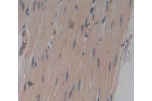 IHC-P analysis of Human Tissue, with DAB staining. (TNNT1 Antikörper  (AA 1-259))