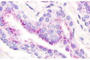 Image no. 1 for anti-G Protein-Coupled Receptor 21 (GPR21) (Transmembrane Domain) antibody (ABIN1048778) (GPR21 Antikörper  (Transmembrane Domain))