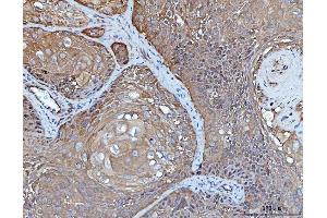 IHC analysis of YWHAE using anti-YWHAE antibody (ABIN7599165).