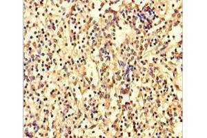 Immunohistochemistry of paraffin-embedded human spleen tissue using ABIN7144155 at dilution of 1:100 (ANKDD1A Antikörper  (AA 272-490))