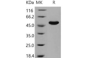 Western Blotting (WB) image for CNDP Dipeptidase 2 (Metallopeptidase M20 Family) (CNDP2) (Active) protein (His tag) (ABIN7320351)