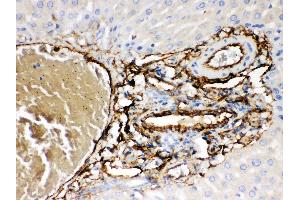 Anti- ABCB4 Picoband antibody, IHC(P) IHC(P): Rat Liver Tissue