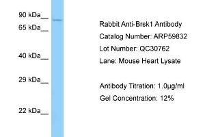 Western Blotting (WB) image for anti-BR Serine/threonine Kinase 1 (BRSK1) (C-Term) antibody (ABIN2788234) (BRSK1 Antikörper  (C-Term))