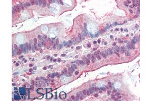 ABIN1590010 (5µg/ml) staining of paraffin embedded Human Small Intestine. (DGAT1 Antikörper  (AA 67-79))