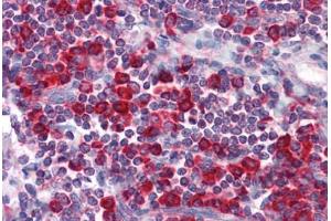 Human Tonsil: Formalin-Fixed, Paraffin-Embedded (FFPE) (MTDH Antikörper)