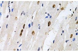 Immunohistochemistry of paraffin-embedded Rat heart using KPNA4 Polyclonal Antibody at dilution of 1:200 (40x lens).