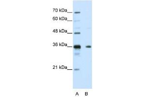 NANOS1 antibody used at 5 ug/ml to detect target protein. (Nanos Homolog 1 Antikörper)