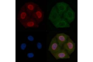 PPP1CA Mouse Monoclonal Antibody staining Hela cells by IF/ICC.