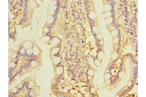 Immunohistochemistry of paraffin-embedded human small intestine tissue using ABIN7171988 at dilution of 1:100 (THTPA Antikörper  (AA 2-230))