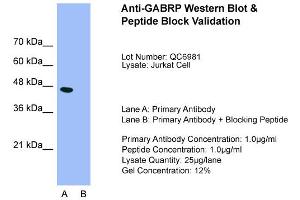 Host:  Rabbit  Target Name:  GABRP  Sample Type:  Jurkat  Lane A:  Primary Antibody  Lane B:  Primary Antibody + Blocking Peptide  Primary Antibody Concentration:  1.